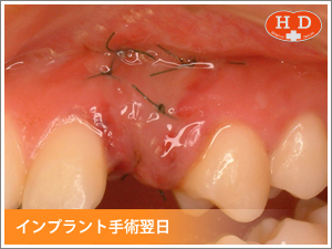 板橋区東武練馬の浜田歯科｜インプラント・入れ歯・審美歯科・CT