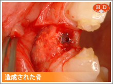 造成された骨